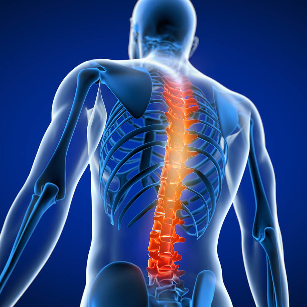 acupuncture for back pain	