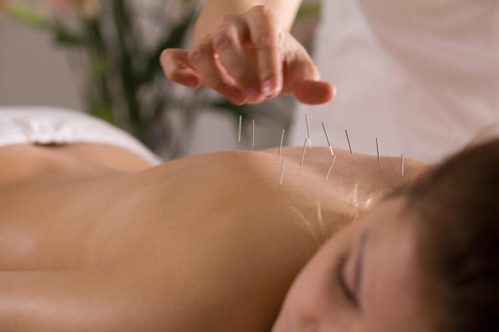 acupuncture-for-back-sciatica acupuncture-for-back-sciatica proto-untypical acupuncture near me