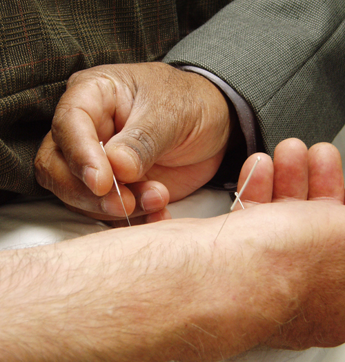 acupuncture1-1 acupuncture1-1 proto-untypical Does Acupuncture Hurt?