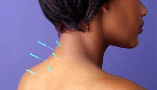 acupuncture; does it hurt?